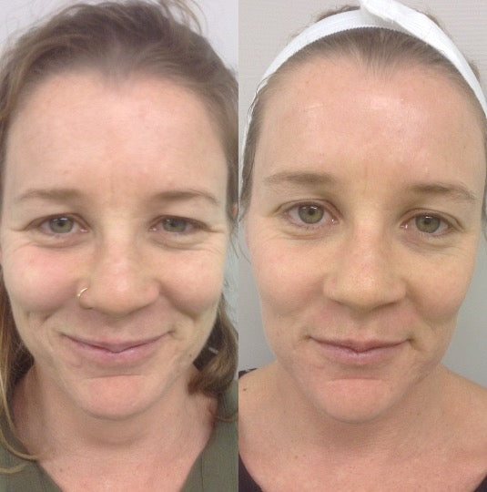 Petsco 12-in-1 Chewable Multivitamin Tablets for Dogs and Cats,  Immune Support、Fur&Coat Support、Digestion Support、Joint Support Dog Treats Supplement 12 in dog supplements Chicken Flavor